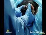 The First Man To Give Birth - Birth Videos